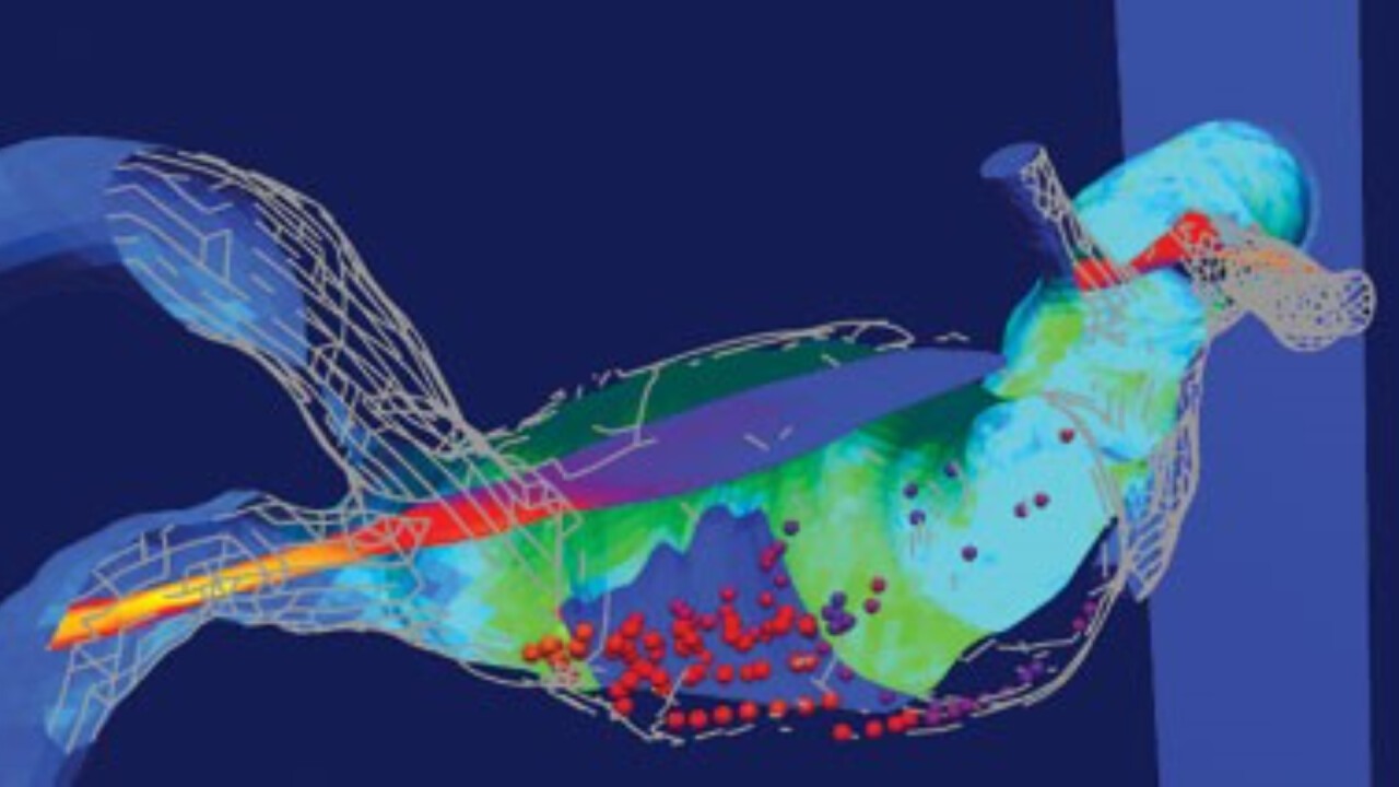 Simulationsmodell Strömung Aneurisma (Bildquelle - Visenso)